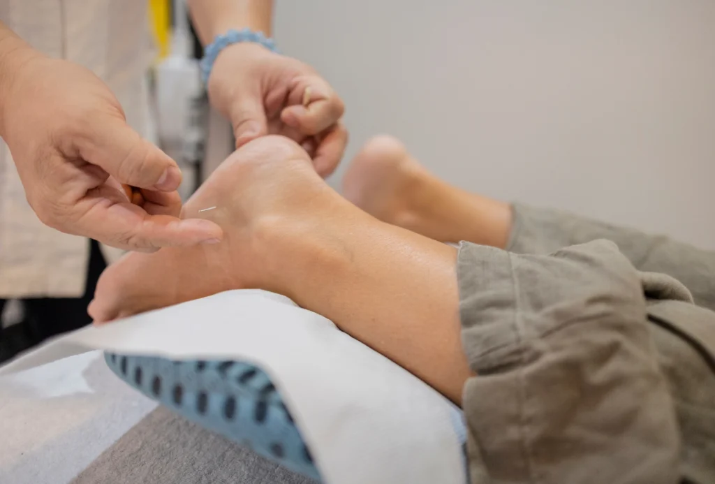 Steve Bailey Acupuncture Academy - Courses - Foundation in Podiatric Medical Acupuncture