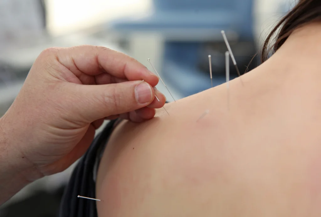 Steve Bailey Acupuncture Academy - Professional Acupuncture Training Courses - 03